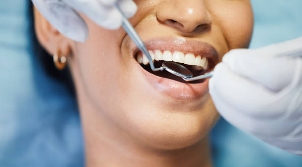 Best Emergency Wisdom Teeth Removal in Camden, AL